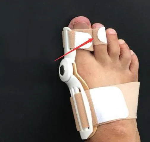 The Bun-Splits Bunion Corrector